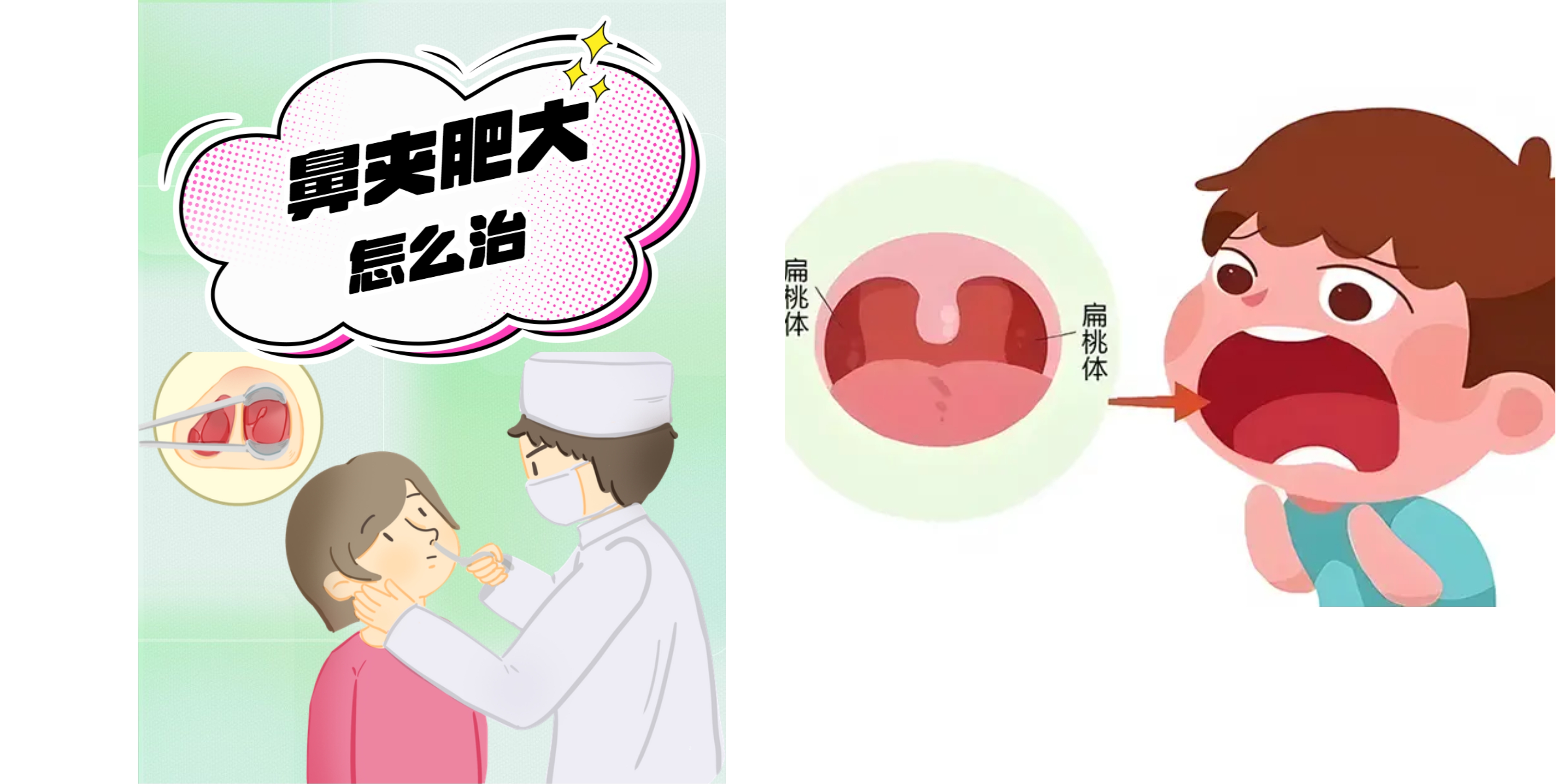 消融電極與普通電刀的區(qū)別有哪些？